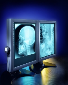Automated Radiologist
